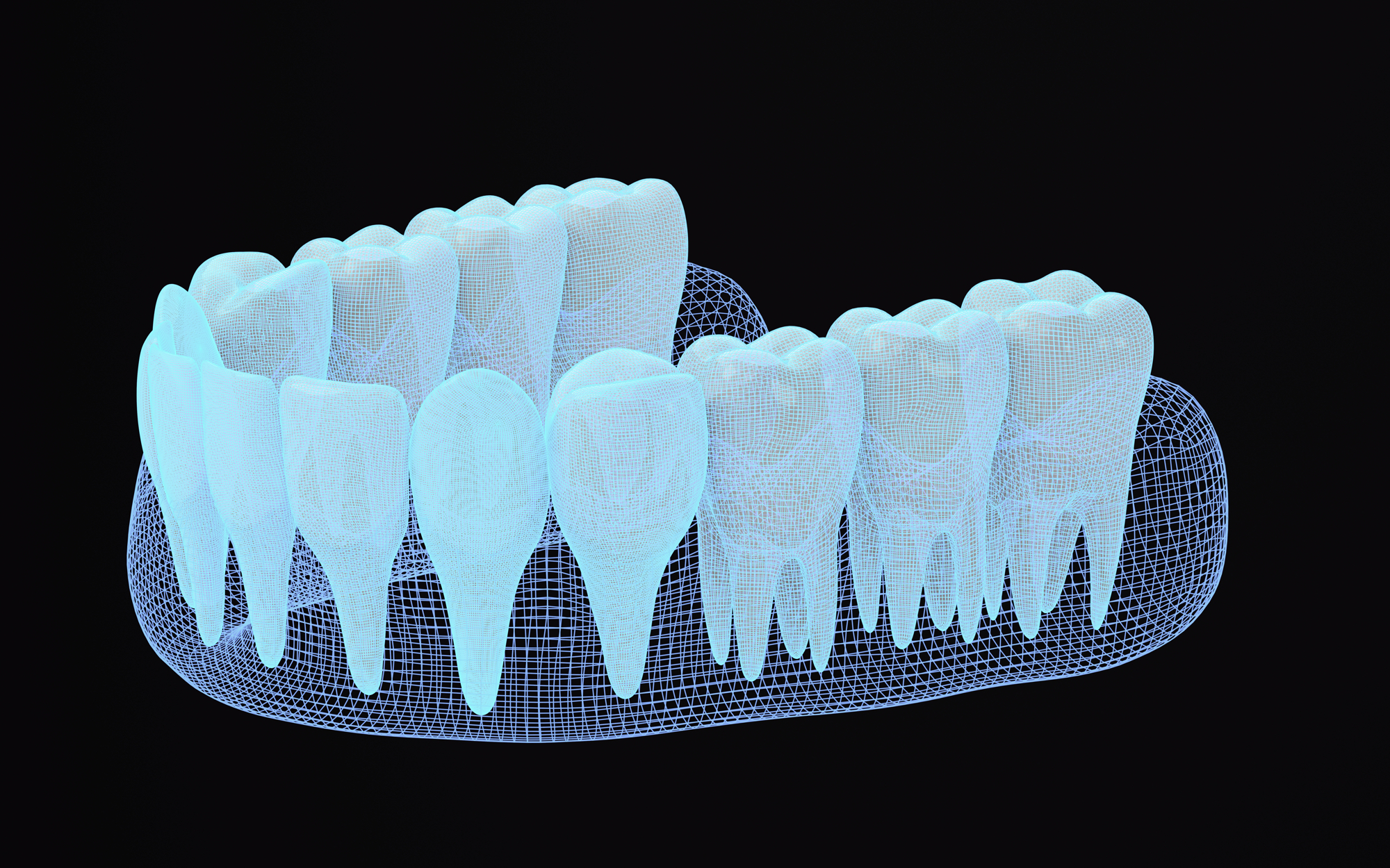 3D slikanje zob – kdaj nam pride najbolj prav