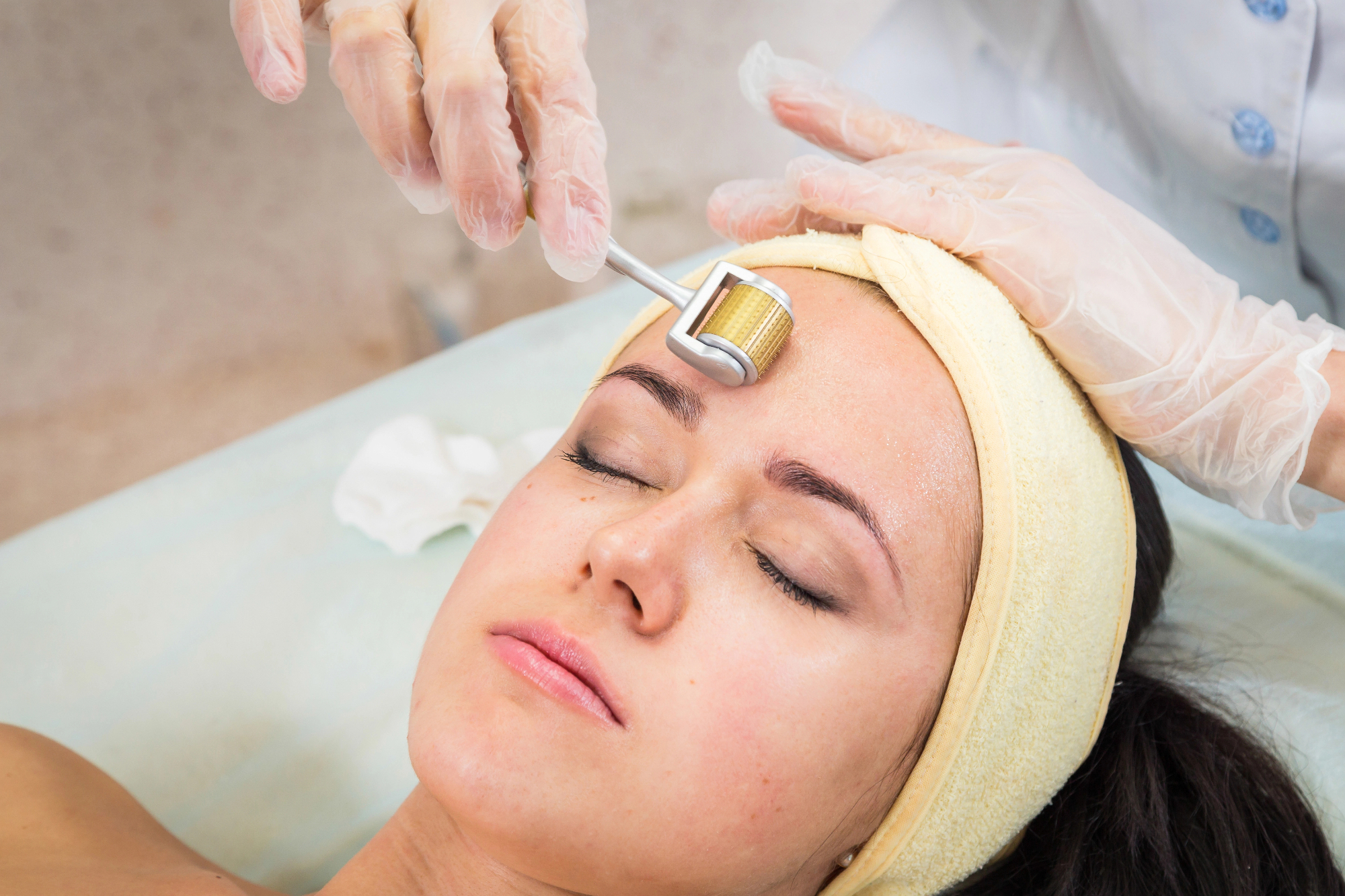 Mezoterapija je osvežitev, ne poseg.